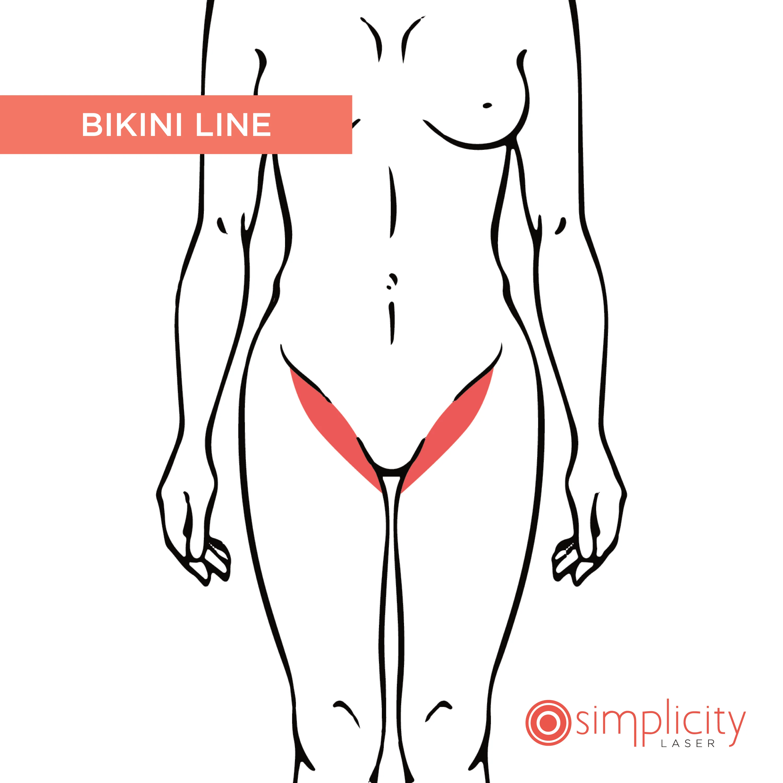 Bikini Line Women's 14-Treatment Monthly Program - Image 2