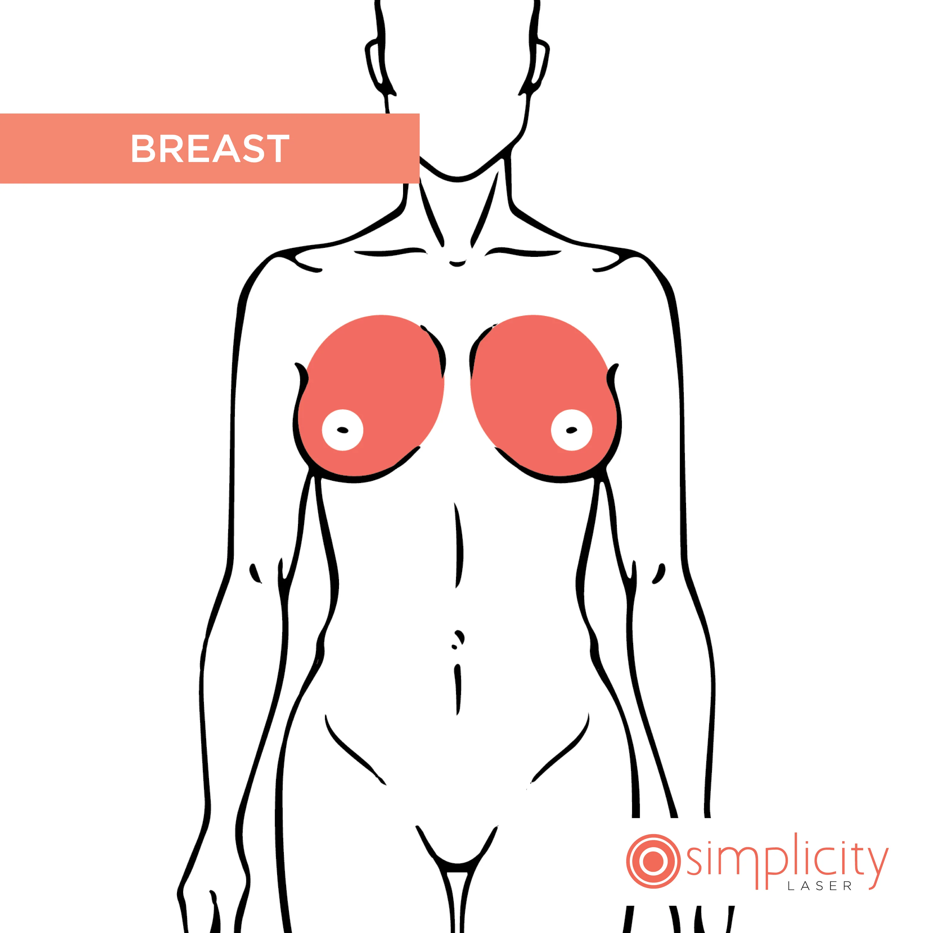 Breast Women's 14-Treatment Monthly Program - Image 2
