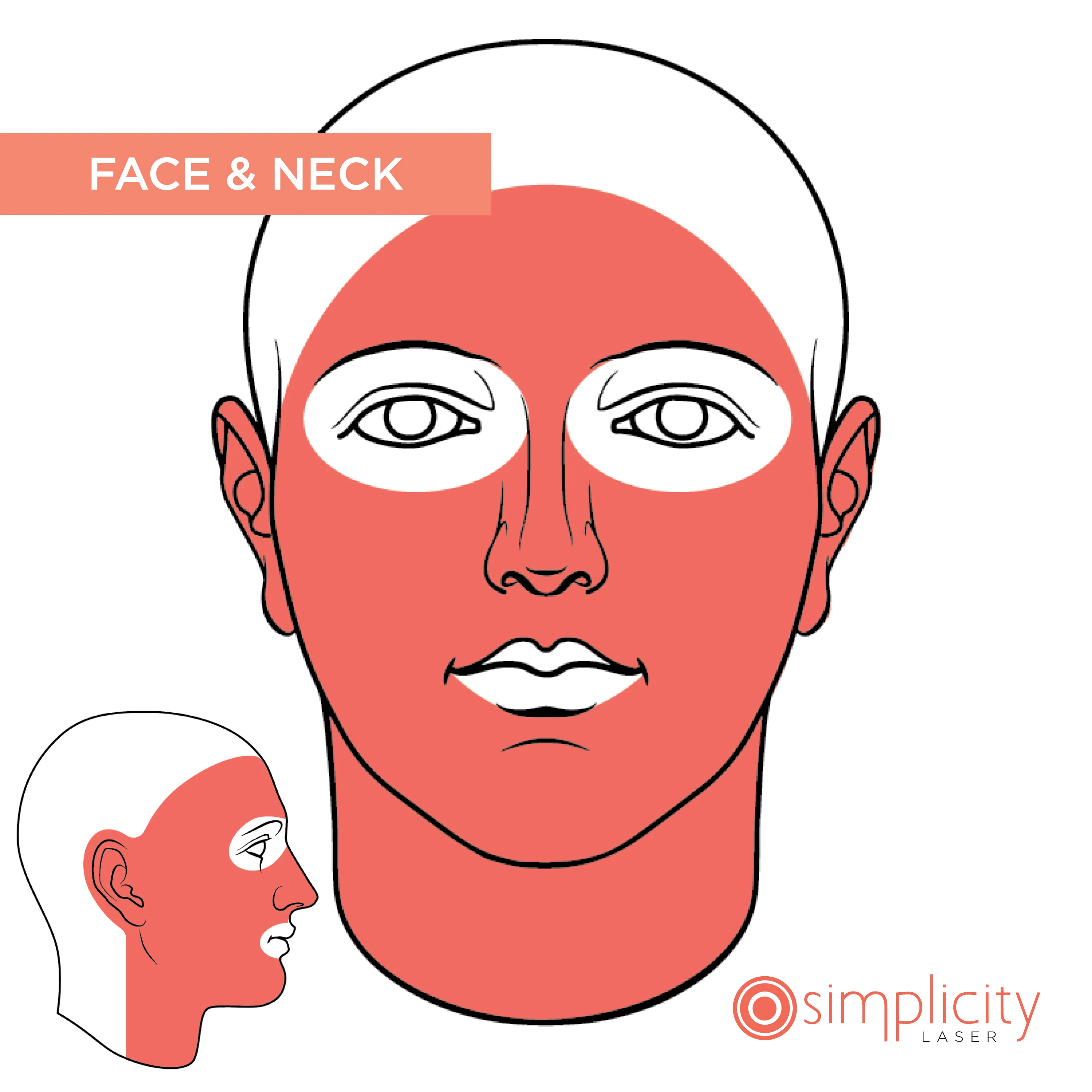 Face & Neck Women's 14-Treatment Program - Image 2
