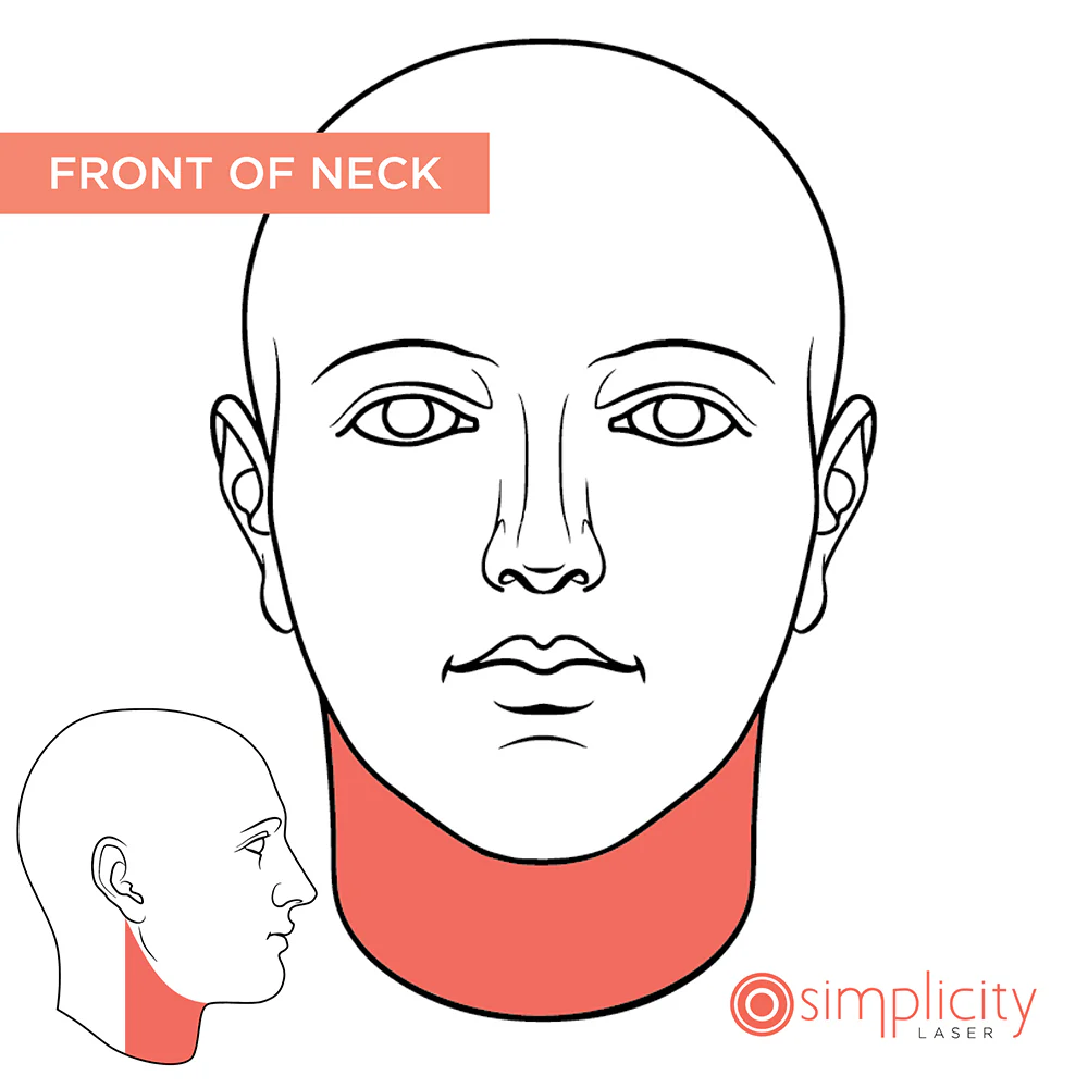 Front of Neck Women's 14-Treatment Monthly Program - Image 2
