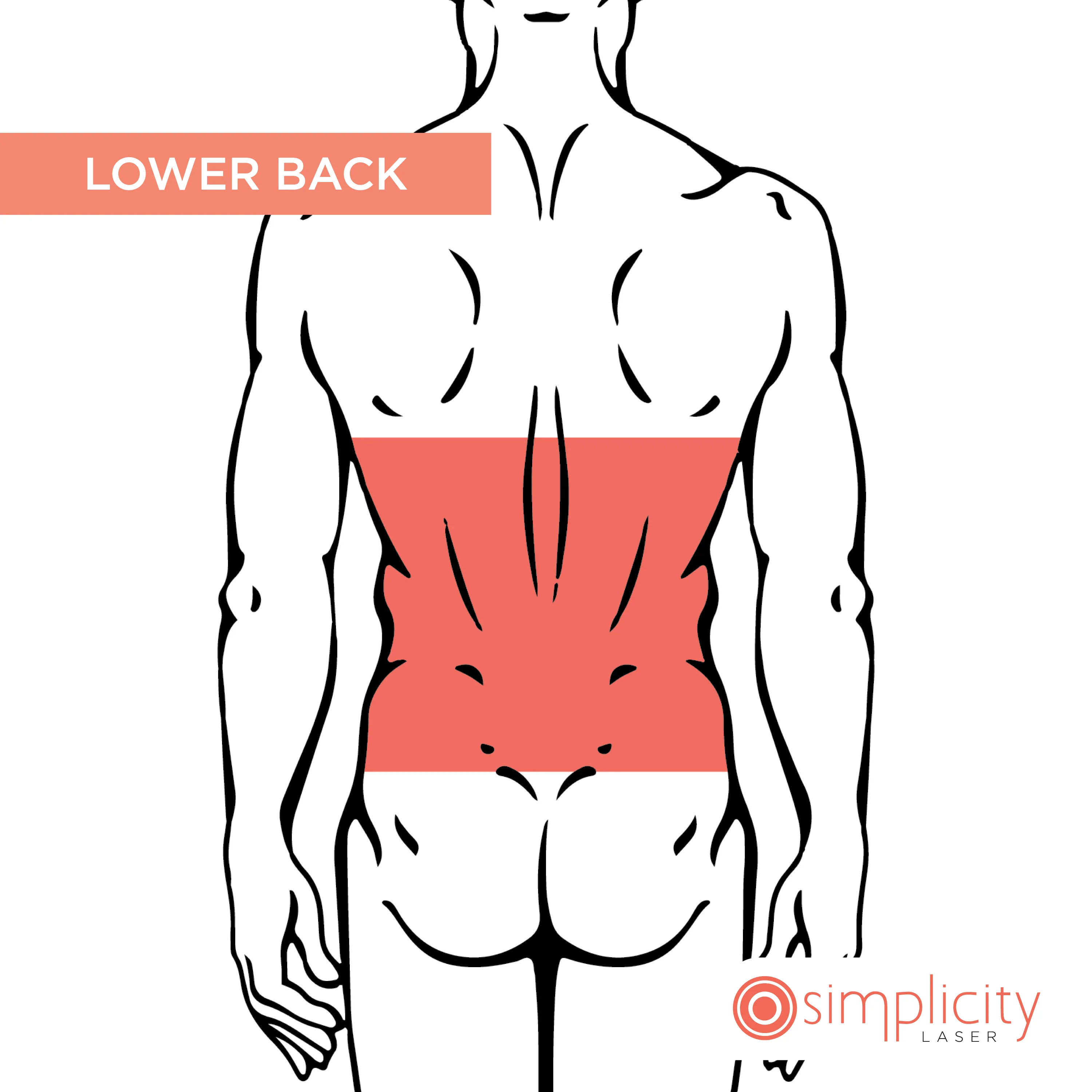 Lower Back Men's 14-Treatment Monthly Program - Image 2