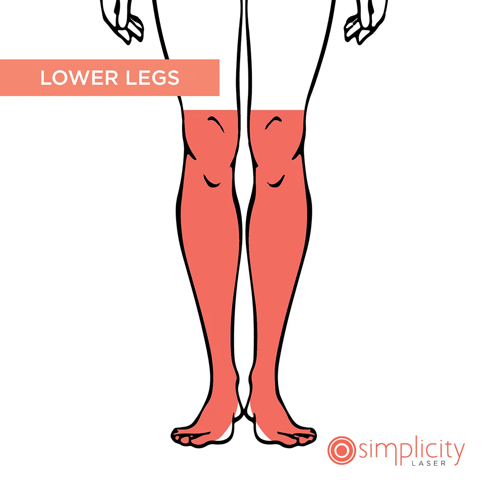 Lower Legs Women's 4-Treatment Starter Package - Image 2
