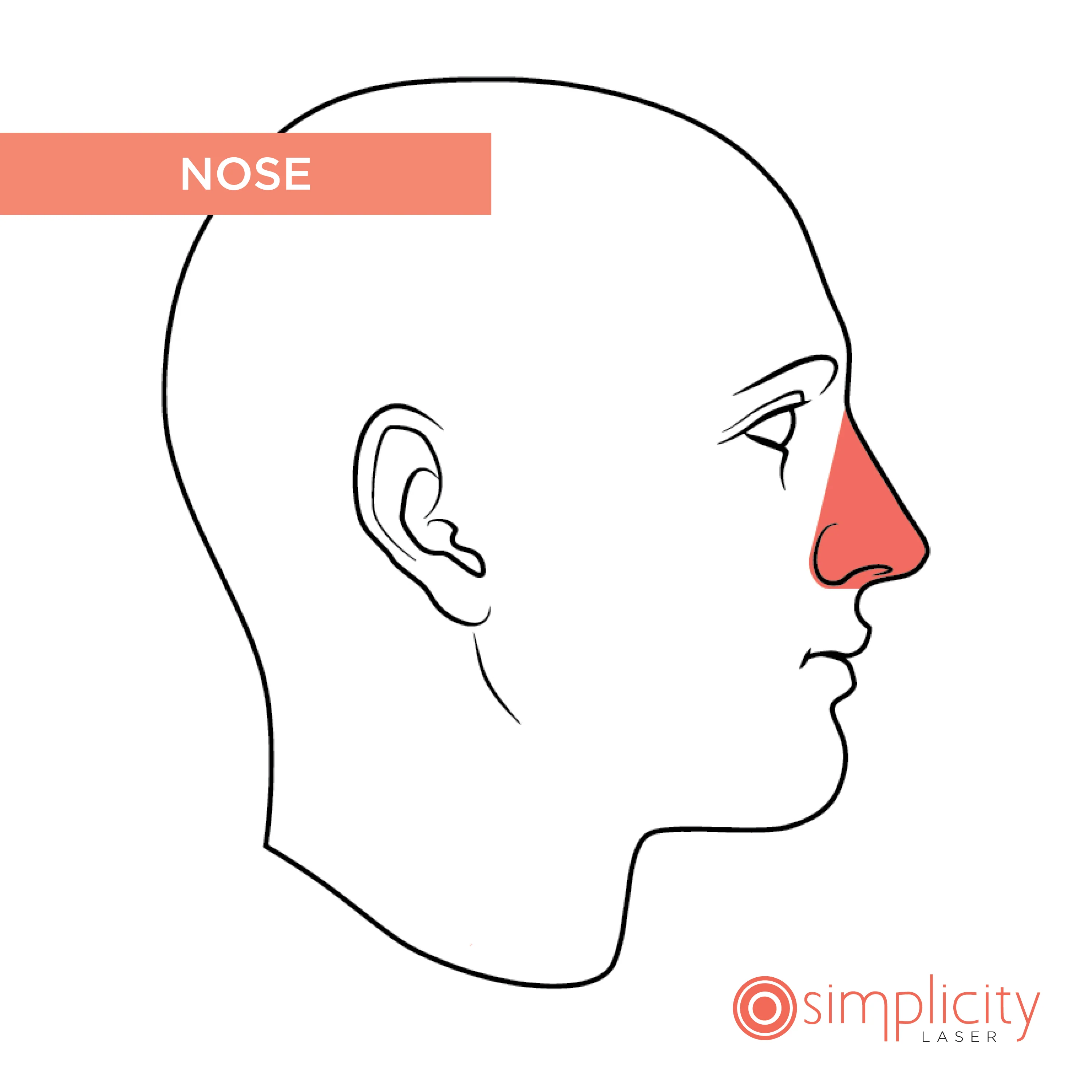 Nose Men's 14-Treatment Monthly Program - Image 2