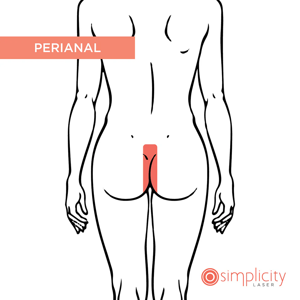 Perianal Women's 14-Treatment Monthly Program - Image 2