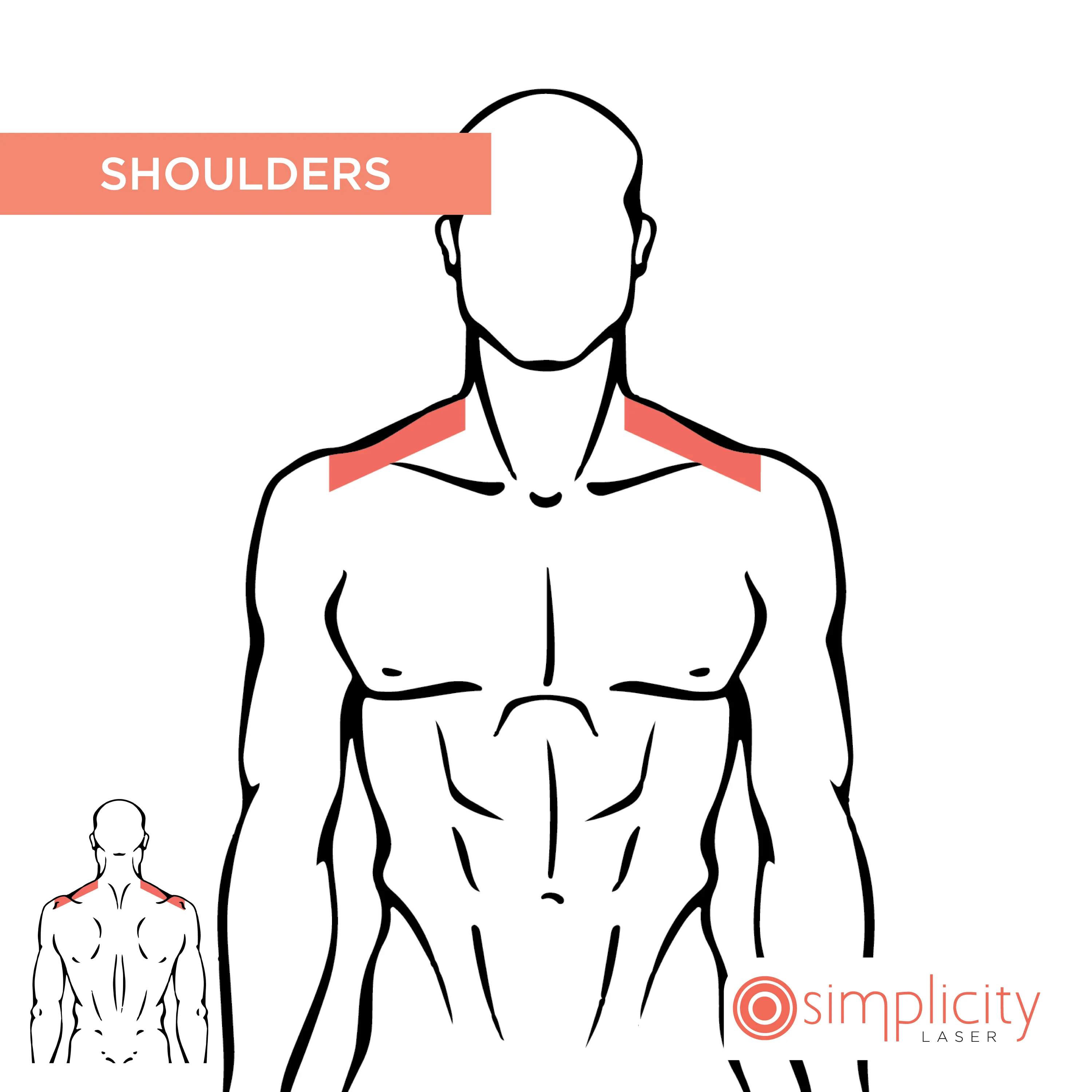 Shoulders Men's 14-Treatment Monthly Program - Image 2