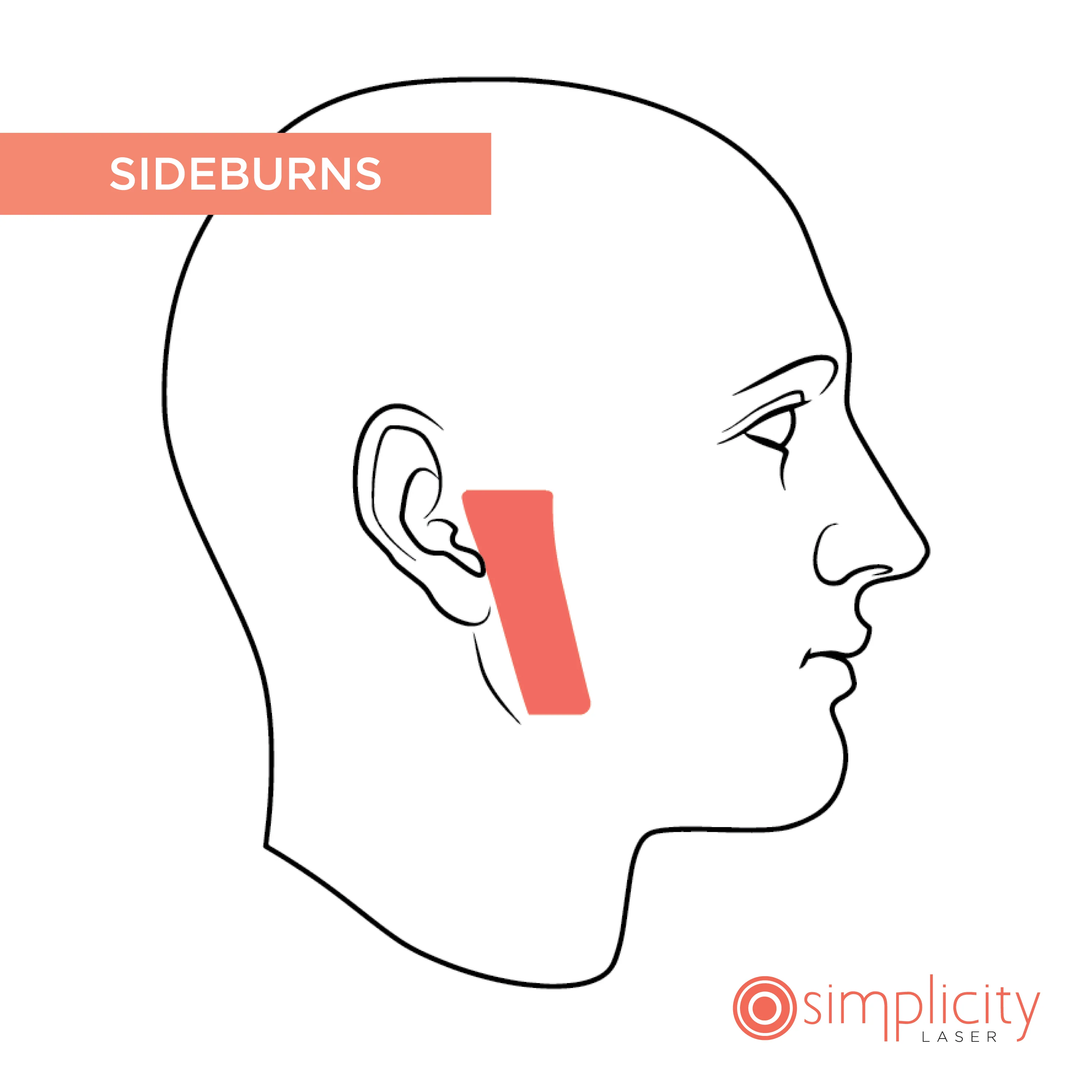 Sideburns Women's 14-Treatment Monthly Program - Image 2