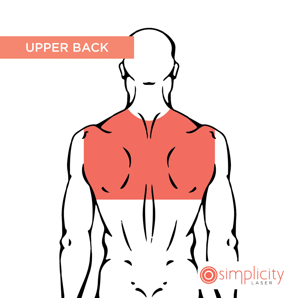 Upper Back Men's 14-Treatment Monthly Program - Image 2