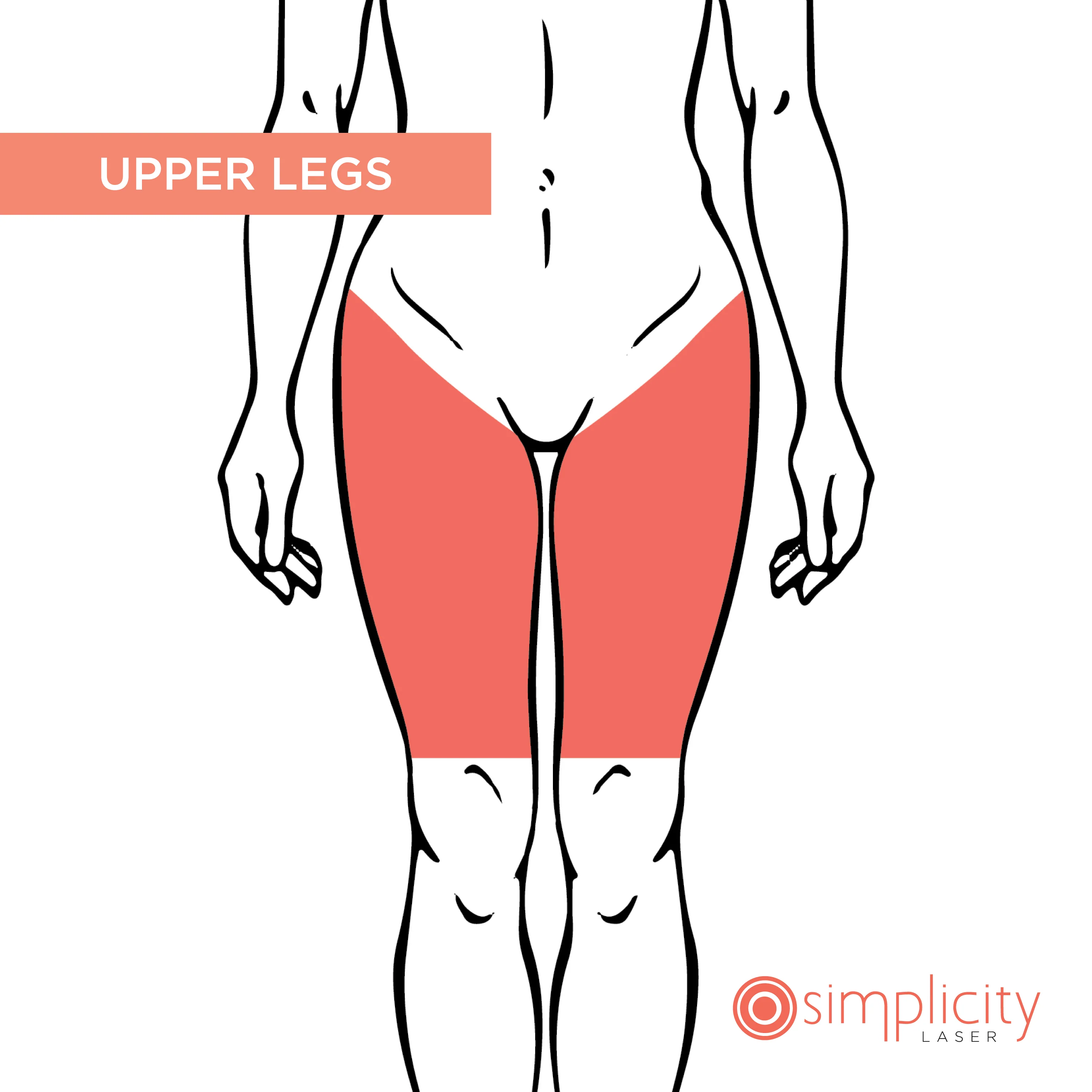 Upper Legs Women's 14-Treatment Monthly Program - Image 2