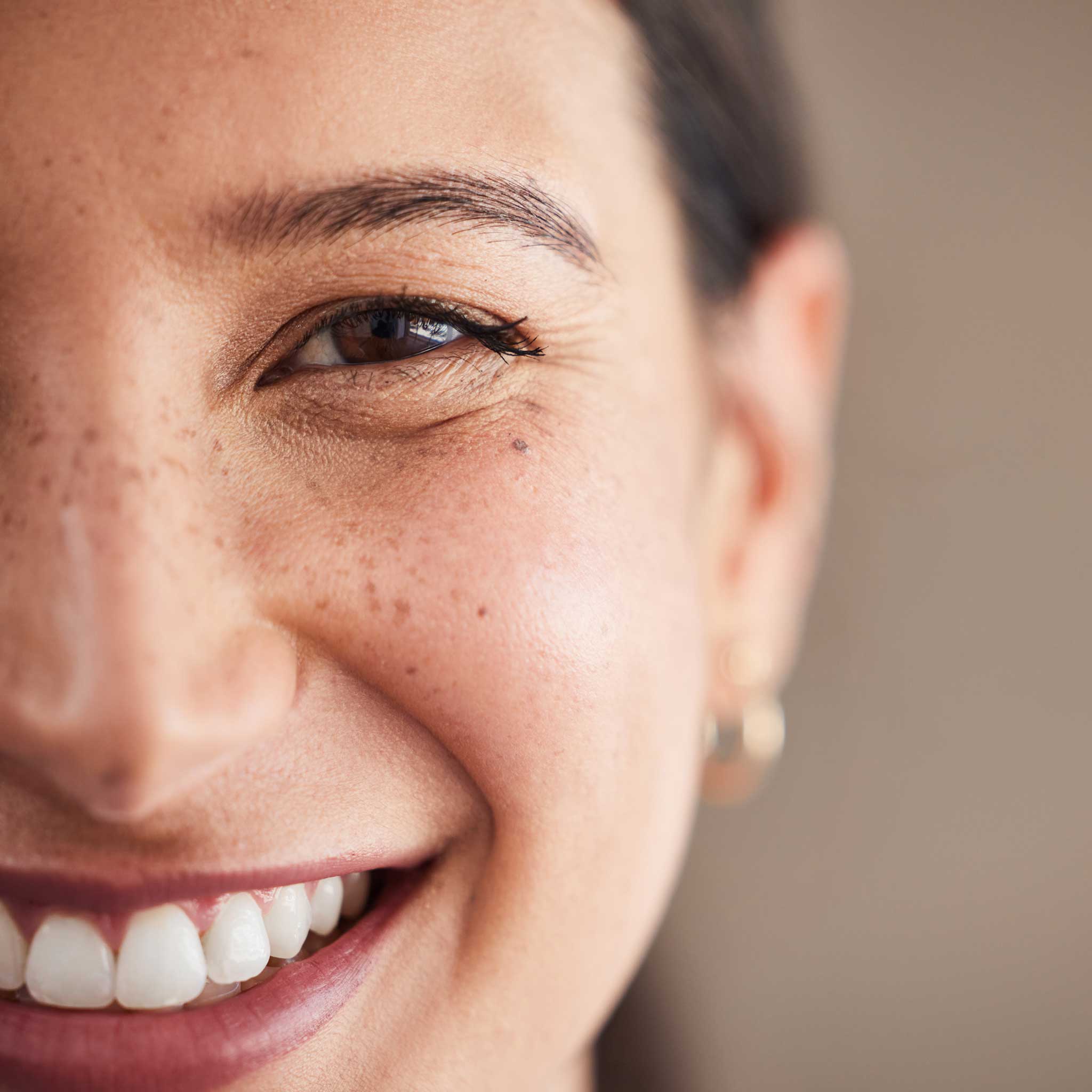 Upper Lip Women's 14-Treatment Monthly Program