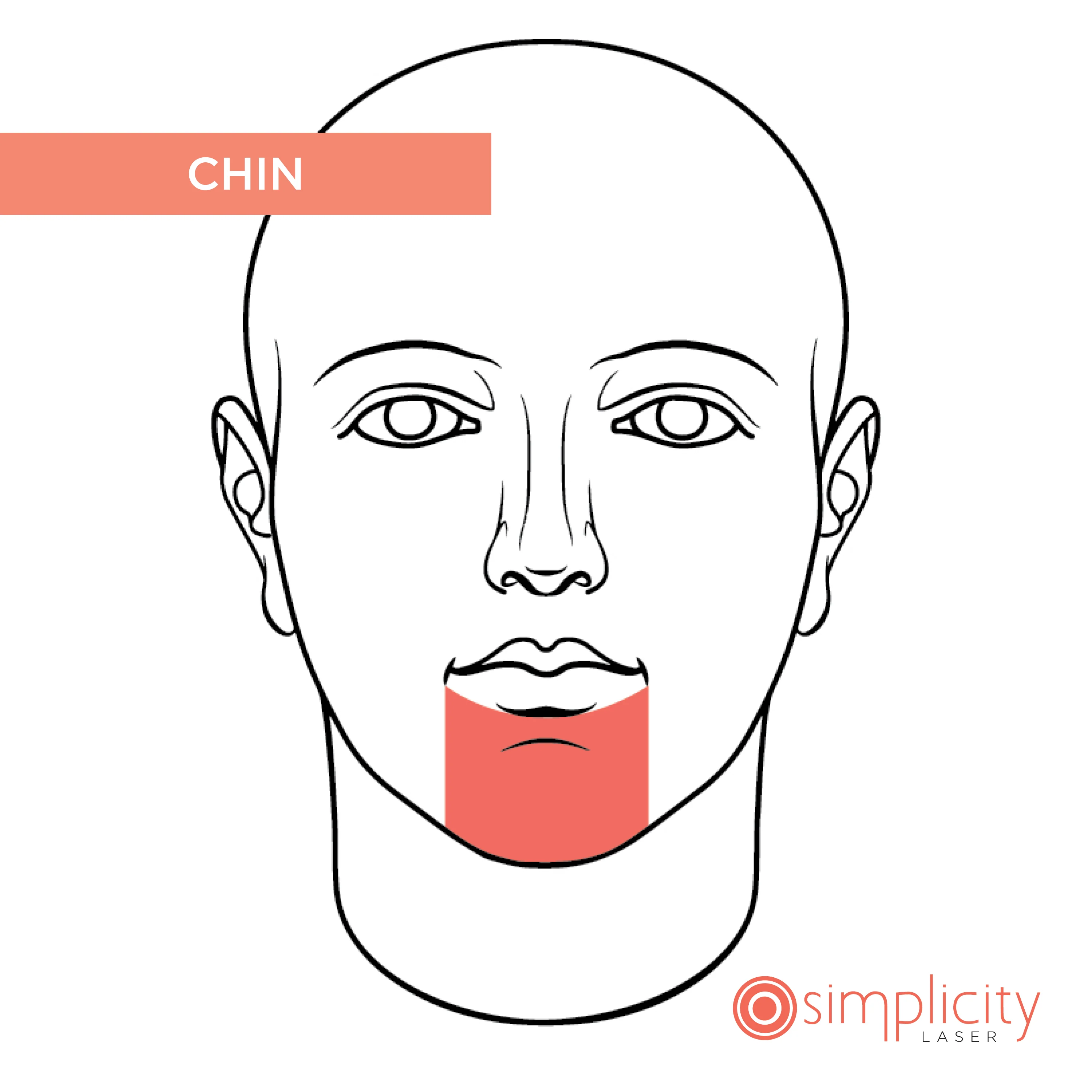 Chin Women's 4-Treatment Starter Package - Image 3